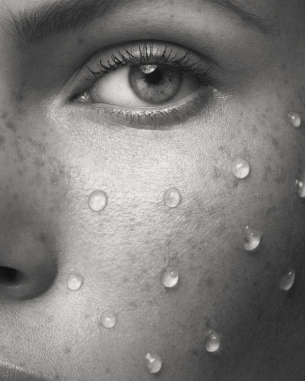 Pre-Wedding Dewy Skin Guide | How to Get a Beautiful and Glowing Complexion