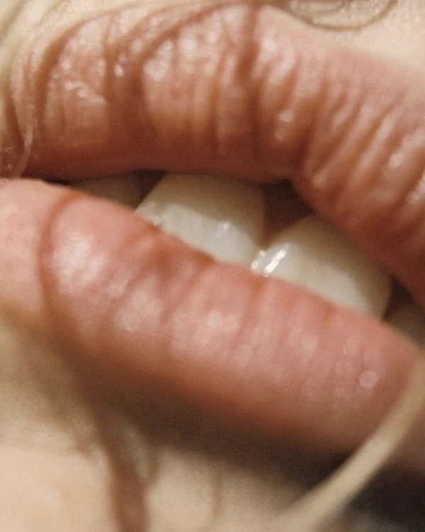 Perfect Smile: Pre-Wedding Teeth Care