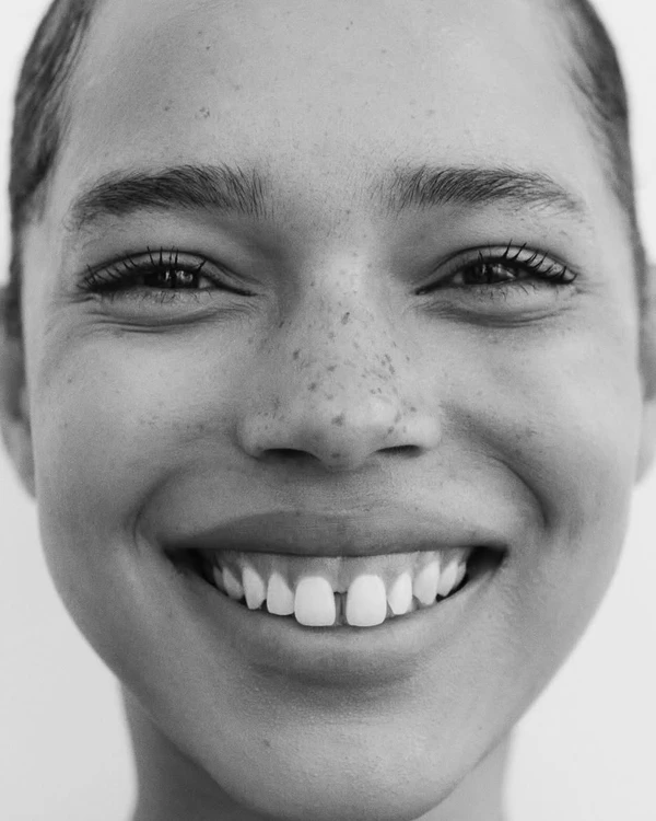 Bridal Teeth Whitening: How to Get a Camera-Ready Smile for Your Wedding