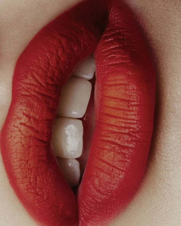 Bridal Teeth Whitening: How to Get a Camera-Ready Smile for Your Wedding — photo 2